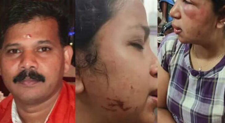 കോട്ടയത്ത്‌ യുവതിക്ക് ഭർത്താവിന്റെ ക്രൂര മർദ്ദനം ; മുഖത്ത് ഗുരുതര പരിക്ക്